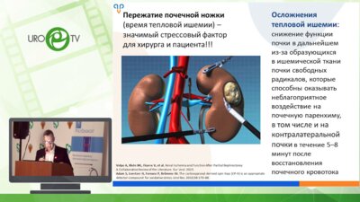 Дорончук Д.Н. - Лапароскопическая лазерная резекция почки