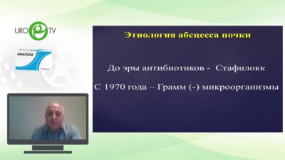 Гулиев Б.Г. - Абсцесс почки: декапсуляция, нефрэктомия или ?