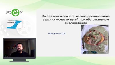 Мазуренко Д.А. - Обструктивный пиелонефрит: тактика ведения пациента