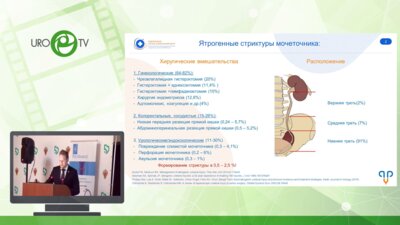Прохоренко К.А. - Ятрогенные стриктуры нижней трети мочеточника - методы лапароскопической коррекции
