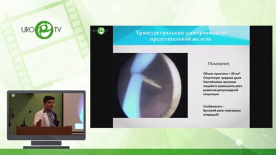 Топузов Т.М. - Основные этапы и принципы оперативных вмешательств -TUEB, Holep, Thulep