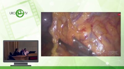 Операционная секция № 3