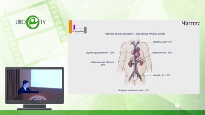 Ахаладзе Д.Г. - Сложности в детской онкохирургии