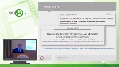 Ефанов М.Г. - Сравнительный анализ открытых и лапароскопических резекций печени при метастазах колоректального рака