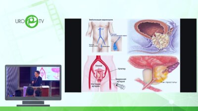 Неймарк Б.А. - Эндоваскулярные методы лечения при заболеваниях предстательной железы