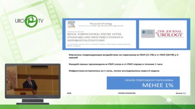 Зенков С.С. - Перкутанная ренальная хирургия. Возможности и пределы