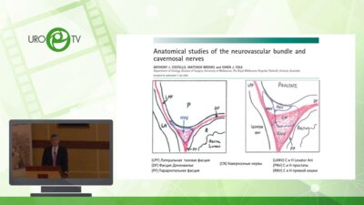 Велиев Е.И. - Радикальная простатэктомия. Экспертное мнение