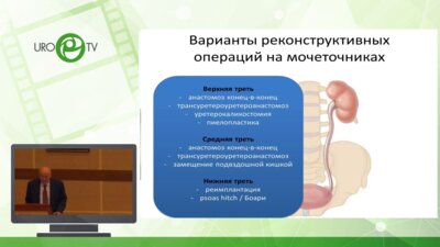 Лоран О.Б. - Реконструктивные операции на верхних мочевых путях. От классических к инновационным