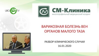 Ординаторская СМ-клиника. Варикозная болезнь вен органов малого таза