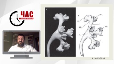 Мазуренко Д.А. - Камни нижней чашечки. Выбор методики и выбор пациентов