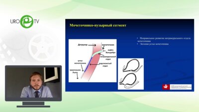Демин Н.В. - Пневмовезикоскопические операции при патологии уретеровезикального соустья у детей