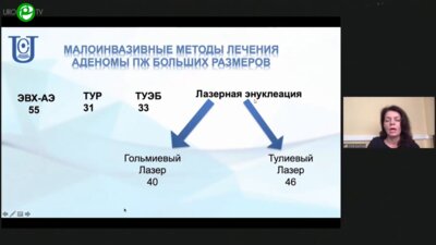 Сушина И.В. - Хирургическое лечение аденомы предстательной железы объёмом больше 80 куб. см. в сравнении ТУР, ТУЭБ, Holep, ЭВХ аденомэктомии