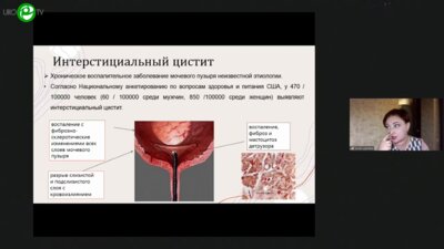 Царёва А.В. - Интерстициальный цистит. Поиск лечебной стратегии