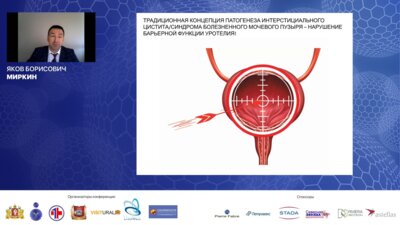 Миркин Я.Б. - Интерстициальный цистит или синдром болезненного мочевого пузыря