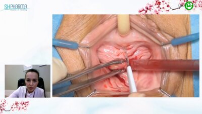 Арефьева О.А - Регулируемые слинги. Анатомические предпосылки. Новые методики