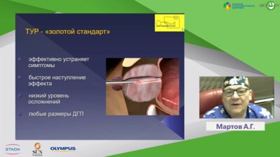 Мартов А.Г. - Профилактика инфекционно-воспалительных осложнений и ирритативных расстройств мочеиспускания после ТУР простаты