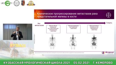 Усынин Е.А. - Возможности системной радиотерапии в лечении больных метастатическим раком предстательной железы