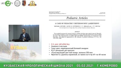 Суров Р.В. - Сравнительный анализ применения электороимпульсного литотриптора «Уролит» и гольмиевого лазера в лечении уретеролитиаза у детей