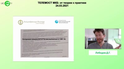 Лебедев Д.Г. - Литолиз крупного камня лоханки. Полное терапевтическое растворение
