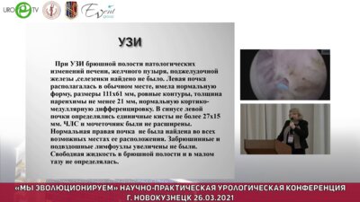 Кольтябина О.Н. - Редкий случай сочетания агенезии почки и эктопии яичника