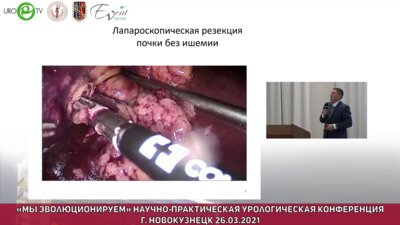 Яловегин А.Д. - Статистика лапароскопических операций. Наш опыт