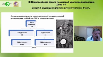 Бондаренко С.Г. - Лапароскопическая экстравезикальная реимплантация с одномоментным