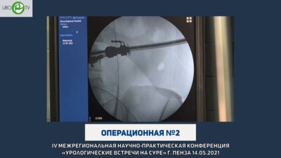 Дымов А.М. - МикроПНЛТ (всевидящая игла)