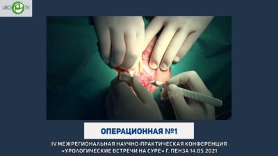 Фаниев М.В. - Установка нового субуретрального слинга при недержании мочи у женщин