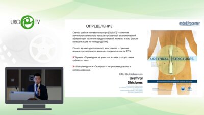 Цой А.В. - Эндовидеохирургическая YV-пластика шейки мочевого пузыря