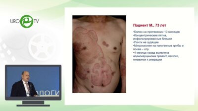 Львов А.Н. - Дермадромы – как индикатор соматического здоровья