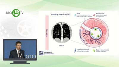 Мацкеплишвили С.Т. - Спорные вопросы протокола лечения SARS-СoV 2