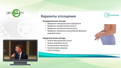 Кызласов П.С. - Утолщение полового члена