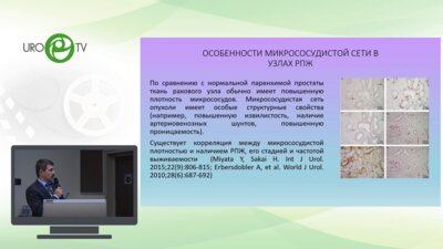 Кадрев А.В. - Диагностика и оценка морфологической значимости рака предстательной железы