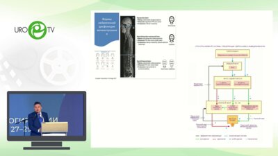 Салюков Р.В. - Химическая денервация в лечении детрузорно сфинктерной диссенергии