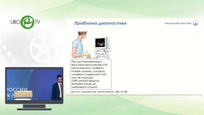 Тивтикян А.С. - Применение обратной транскриптазы теломеразы (ТЕRТ) в неинвазивной диагностике рака мочевого пузыря