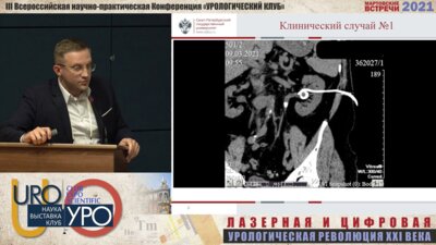 Горгоцкий И.А. - Лапароскопия при мочекаменной болезни в эпоху РИРС и ПНЛ излишество или необходимость