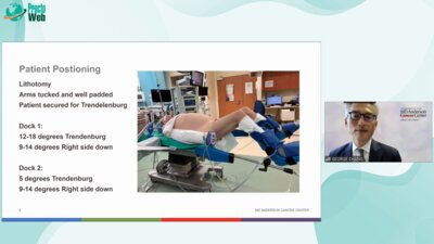 George Chang - Set Up And Port Placement