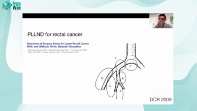 Rodrigo Oliva Perez - Technical Concept and Anatomy in MIS