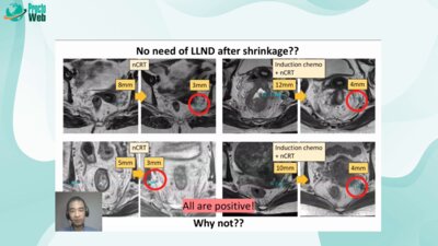 Takashi Akiyoshi - Always if Initially Positive Regardless of the Shrinkage