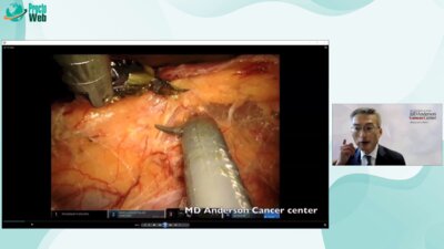 George Chang - Multivesicular Resection for T4 Tumor
