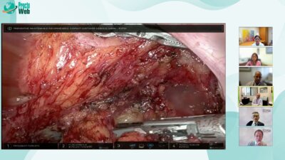 Julio Garcia-Aguilar - Tumor-specific mesorectal excision and transection