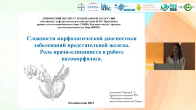 Морова Е.В. - Сложности морфологической диагностики заболеваний предстательной железы