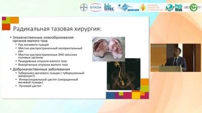 Холтобин Д.П. - Профилактика и лечение ранних и поздних осложнений лапароскопической цистэктомии