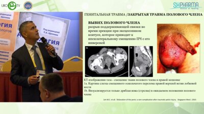 Назаров Т.Х. - Генитальная травма и инородные тела полового члена – стандарты лечения