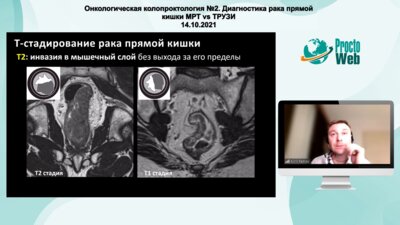 Петров К.С. - МРТ - основы и advanced уровень в диагностике рака прямой кишки
