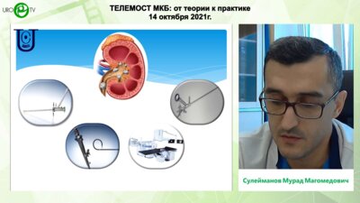 Сулейманов М.М. - Клинический случай, преемственность методов лечения коралловидного нефролитиаза