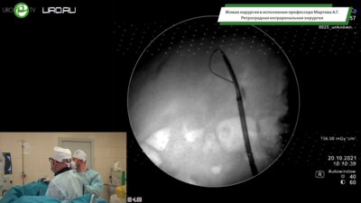 Мартов А.Г. - Ретроградная интраренальная хирургия