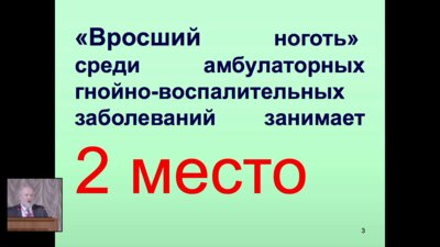 Павлов Ю.И. - Пластика околоногтевых валиков в комбинации с ортониксической коррекцией при вросшем ногте
