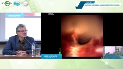 Лазерная аблация опухоли