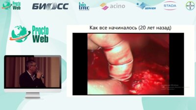 Бусырев Ю.Б. - Мои интраоперационные осложнения в колоректальной хирургии